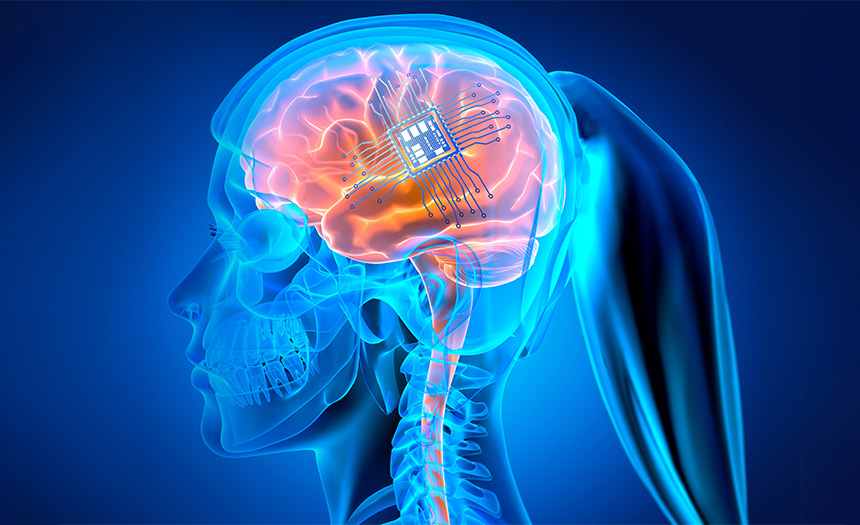 Neuralink